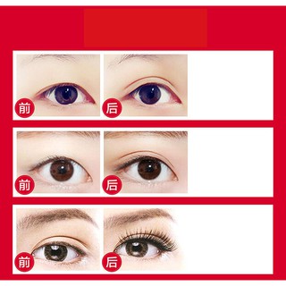 Keo kích mí-dán mi Eye Cream