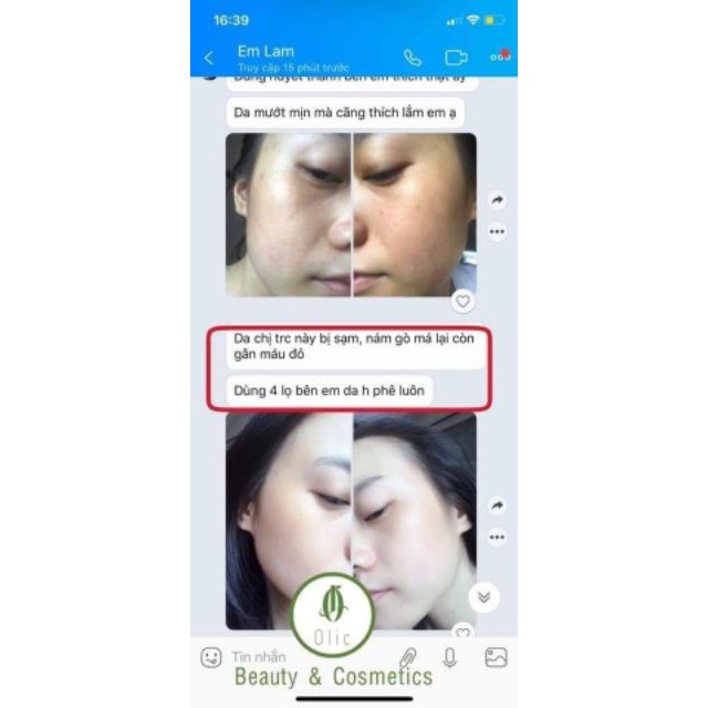 Serum Truyền Trắng 7 Days Olic 10ml - [ Hàng Chuẩn Cty ] | BigBuy360 - bigbuy360.vn