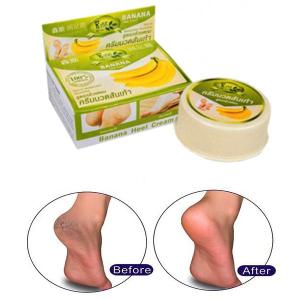 Kem trị nứt gót chân Banana Heel Cream - KM