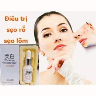 Serum Sẹo Rỗ Lâu Năm Tái Tạo Da