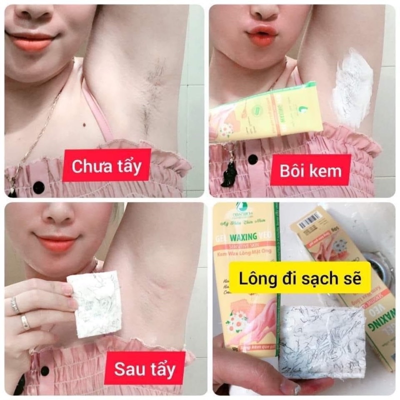 Kem tẩy lông ngân bình,kem wax lông ngân bình chính hãng