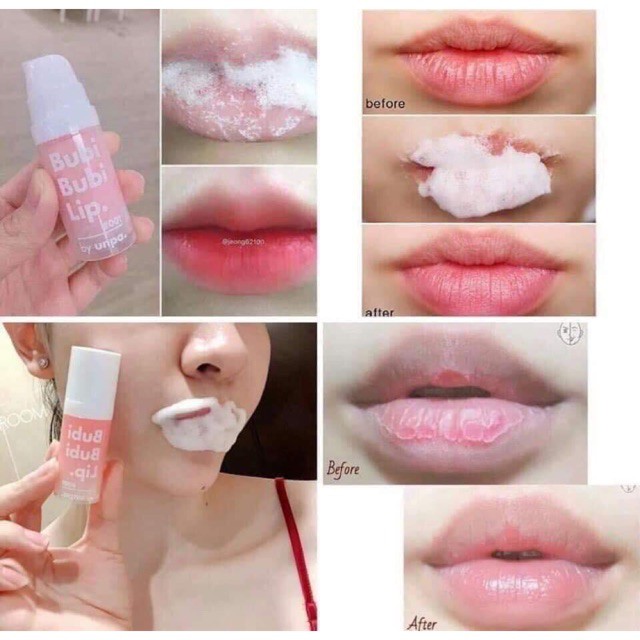 Tẩy Da Chết Sủi Bọt Thải Độc Môi Bubi Bubi Lip