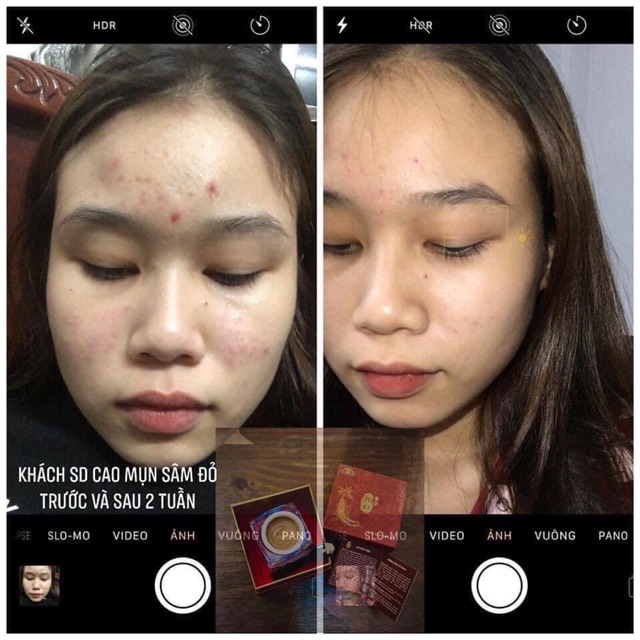 36 VỊ - CAO MỤN SÂM ĐỎ 5GR | BigBuy360 - bigbuy360.vn