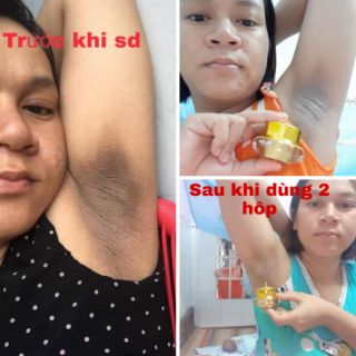 SIÊU DƯỠNG THÂM 5s BIHO LADI