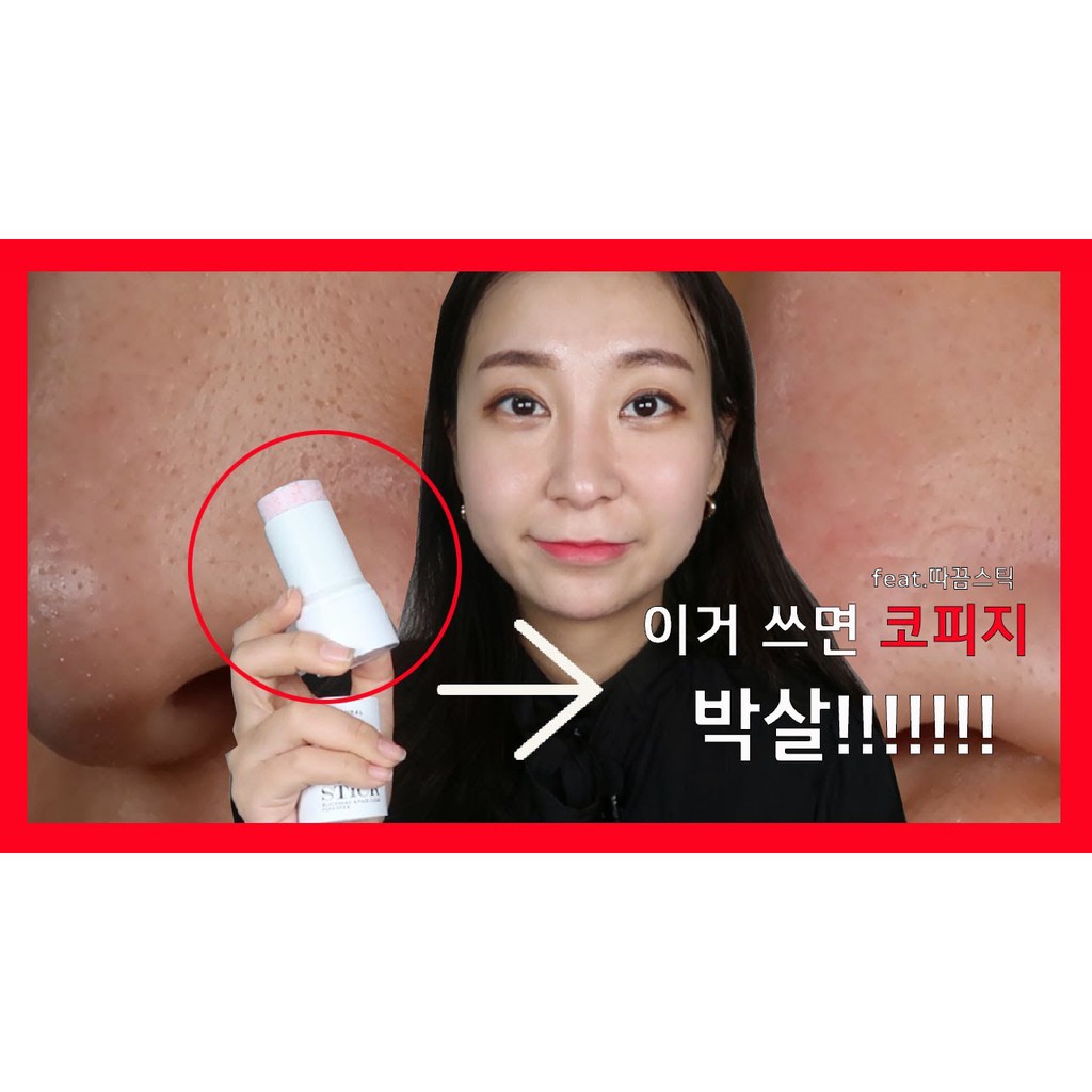 Thanh lăn mụn So’natural Red Peel Clear Stick | BigBuy360 - bigbuy360.vn