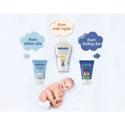 KUTIESKIN kem bôi chàm sữa cho bé, lác sữa giúp giảm ngứa, giảm viêm, cải thiện bong tróc da, dưỡng ẩm sâu cho da