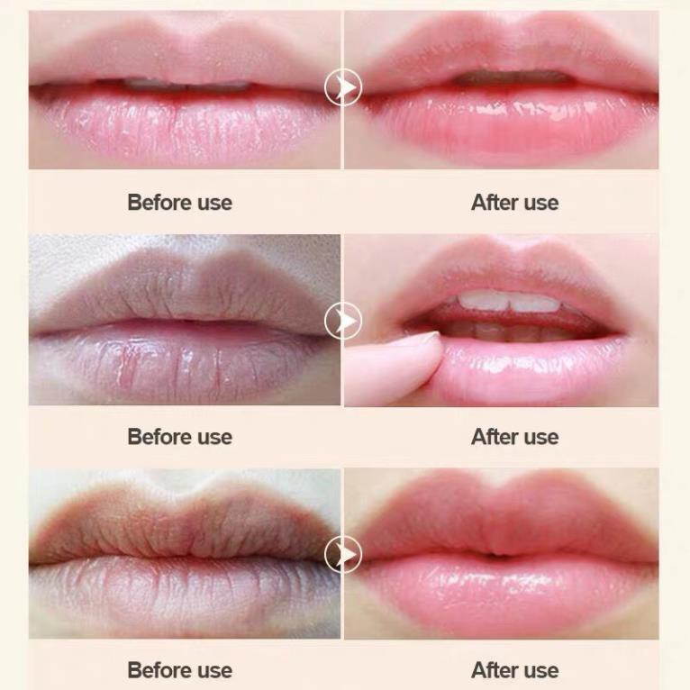 HIISEES - Mặt nạ môi hoa hồng dưỡng ẩm mềm môi căng mọng Rose Moisturizing Lip Mask[ Chính hãng]