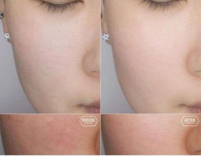 TINH CHẤT DƯỠNG DA SERUM 9WISHES