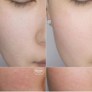 TINH CHẤT DƯỠNG DA SERUM 9WISHES