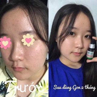 Serum Gon