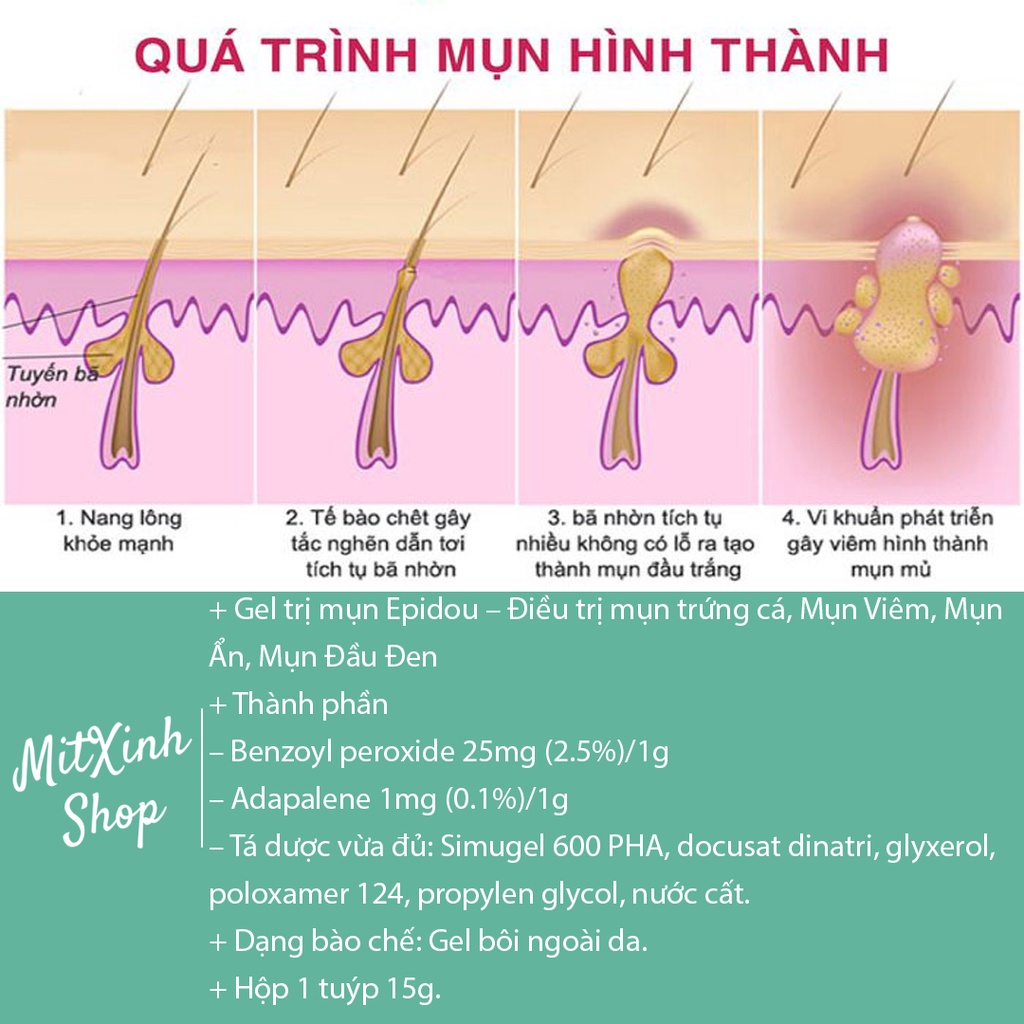 Gel chấm mụn Epidou 15g