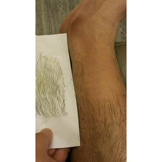Was lông vĩnh viễn nách,chân, tay....