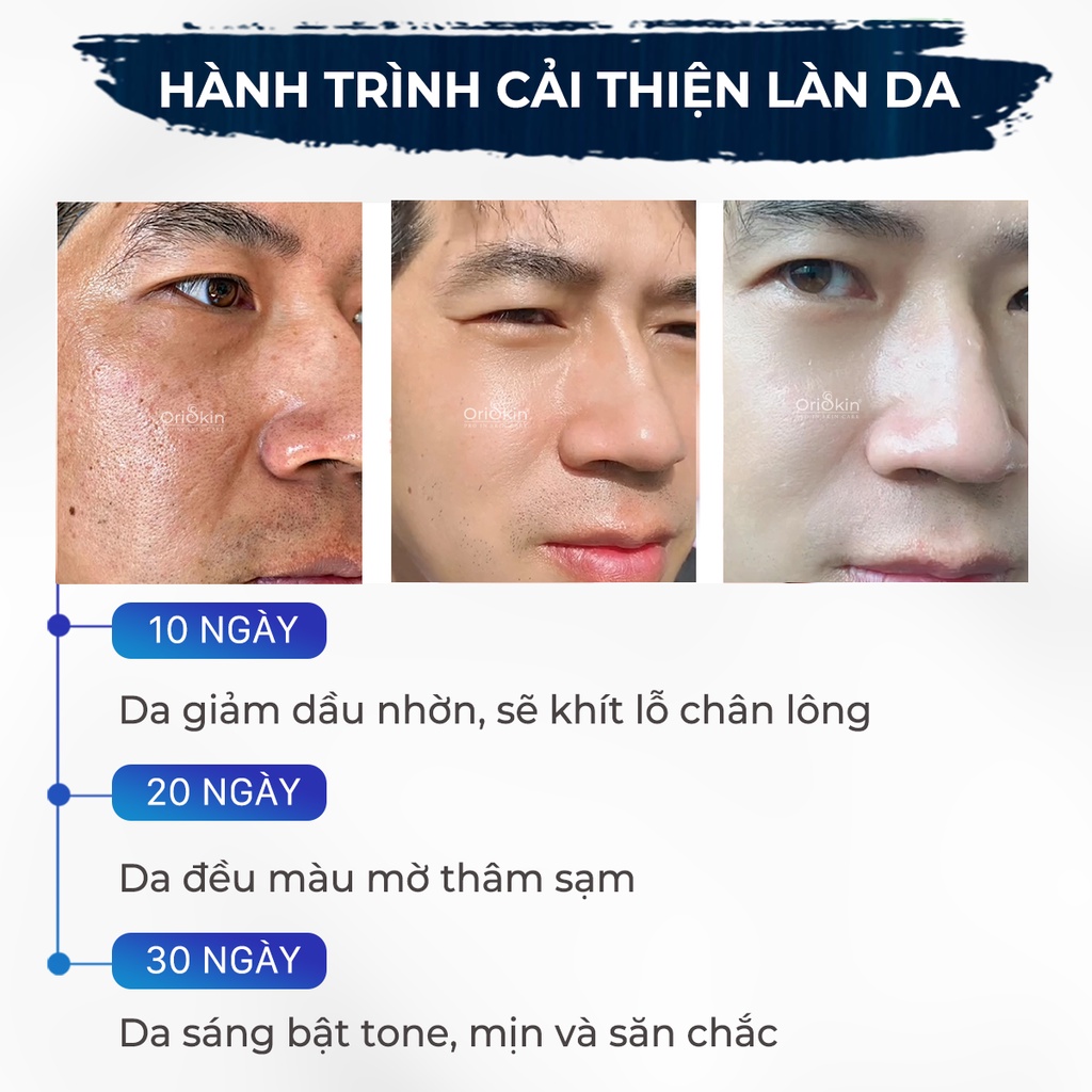 Serum Dưỡng Trắng , Mờ Nám, Tàn Nhang,  Se Khít  Lỗ Chân Lông Da Dành Cho Nam Giới Oriskin Brightening Serum 20 ml