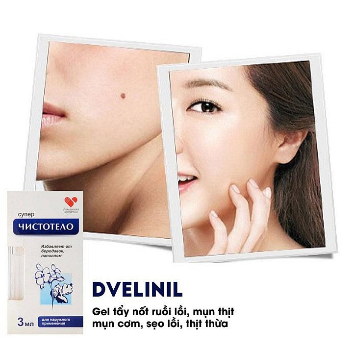 Gel &quot;Thần&quot; Dvelinil của Nga Tẩy Nốt Ruồi, Mụn Cóc, Mụn Thịt, Sẹo Lồi