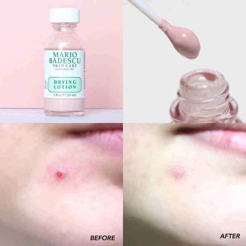 【Từ tp Hồ Chí Minh gửi hàng】CHẤM MỤN MARIO Badescu Drying Lotion 29ml - dung dịch chấm mụn