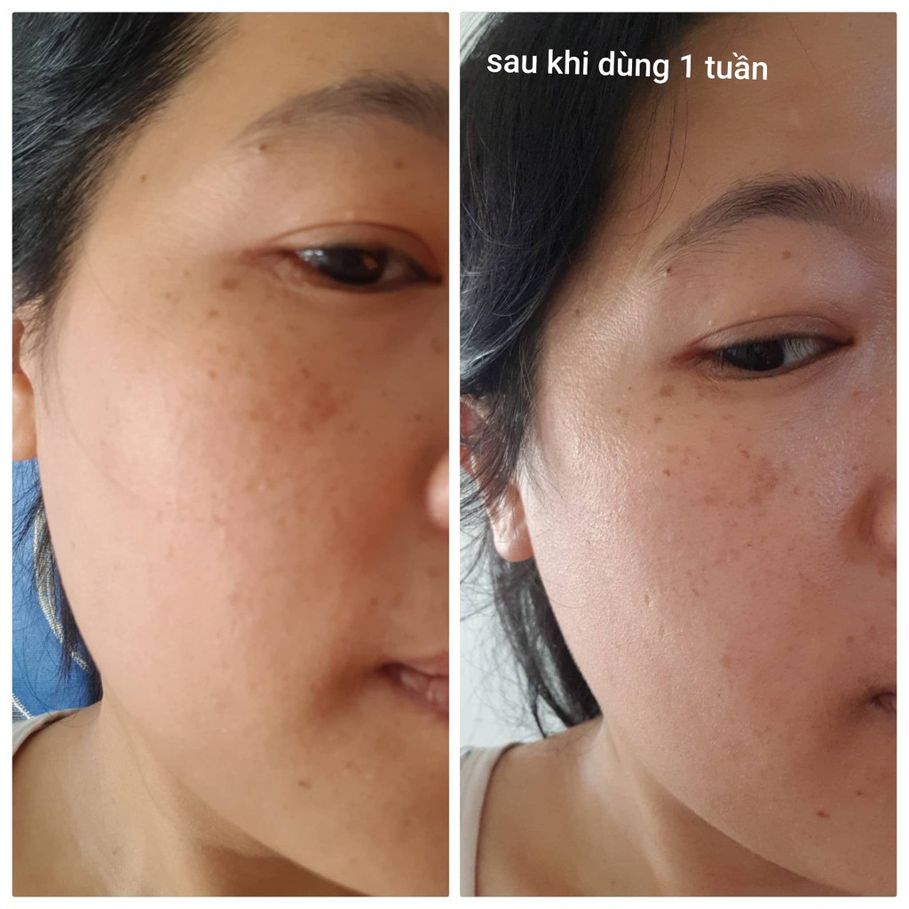 [CHÍNH HÃNG] Viên uống trắng da Nine's Beauty Chống lão hóa Giảm Nếp Nhăn giảm nám tàn nhang, Cân bằng Nội tiết Nines