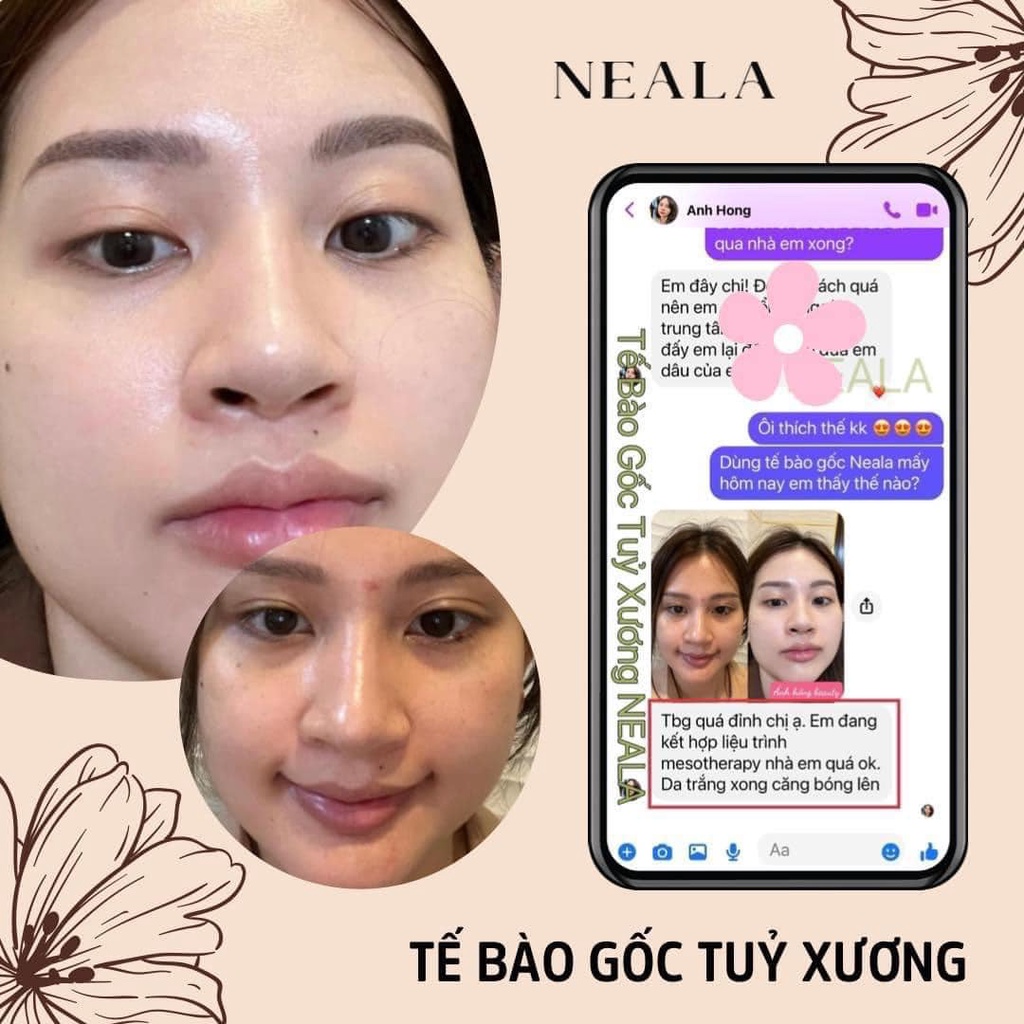 TẾ BÀO GỐC TUỶ XƯƠNG NEALA