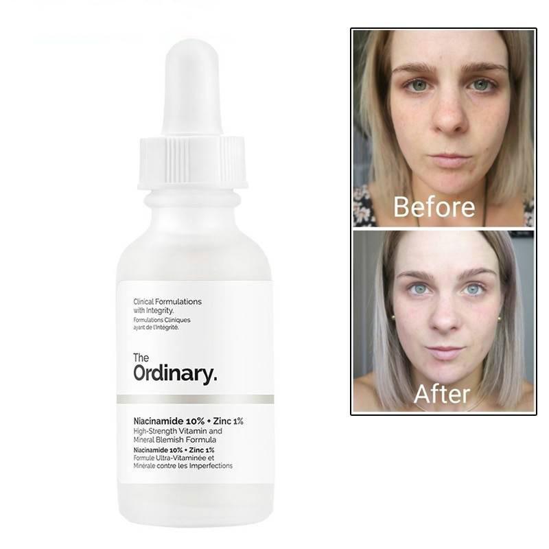 (Hàng Mới Về) Tinh Chất The Ordinary Niacinamide 10% + Zinc 1% 30ml