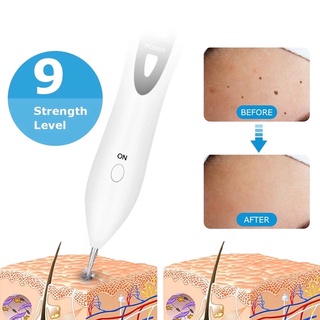 Máy Đốt Nốt Ruồi , Mụn, đốt mụn thịt dùng trong spa