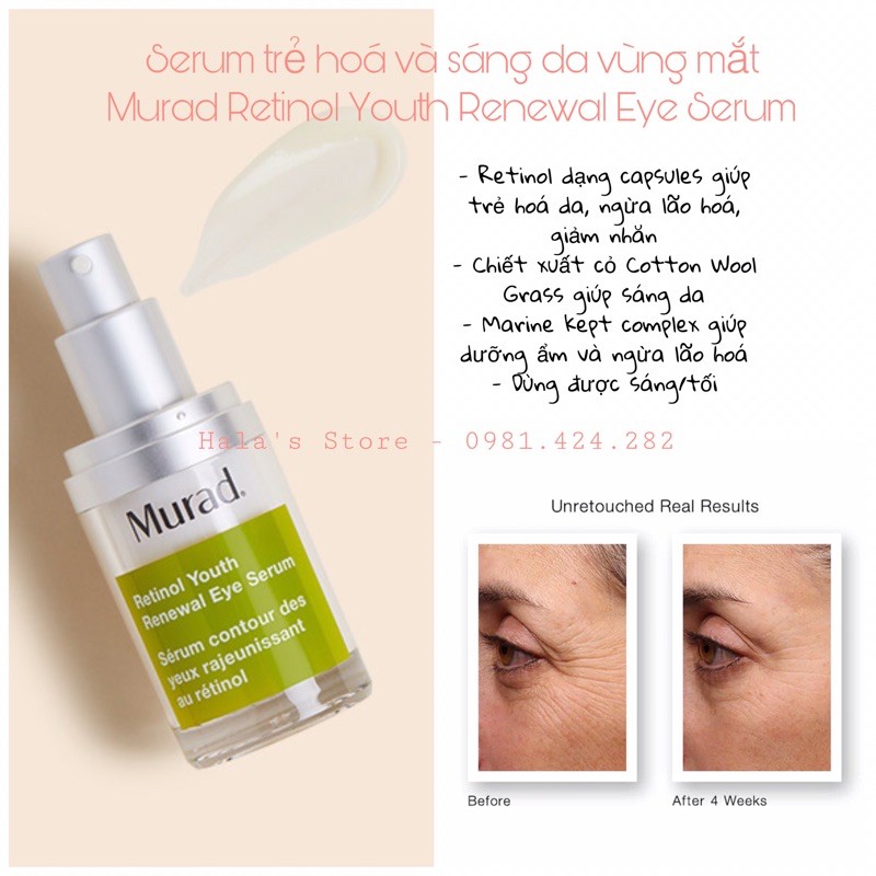 Murad ✨ Serum và kem dưỡng chống lão hoá da vùng mắt Retinol Youth Eye Cream/Serum