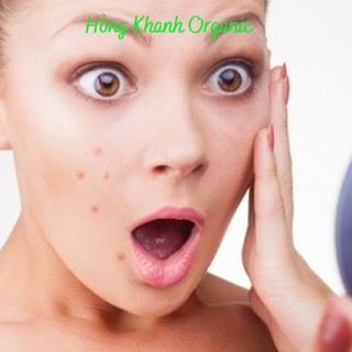 Dầu mù u ép lạnh Noom (tamanu oil)