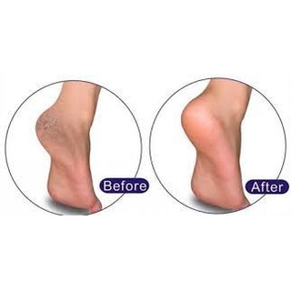 [ FREE SHIP] Kem trị nứt gót chân Balea của Đức 50ML