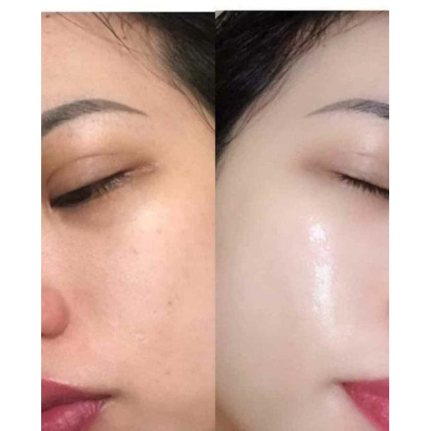 Ủ trắng kén tằm LSKIN WHITE | BigBuy360 - bigbuy360.vn