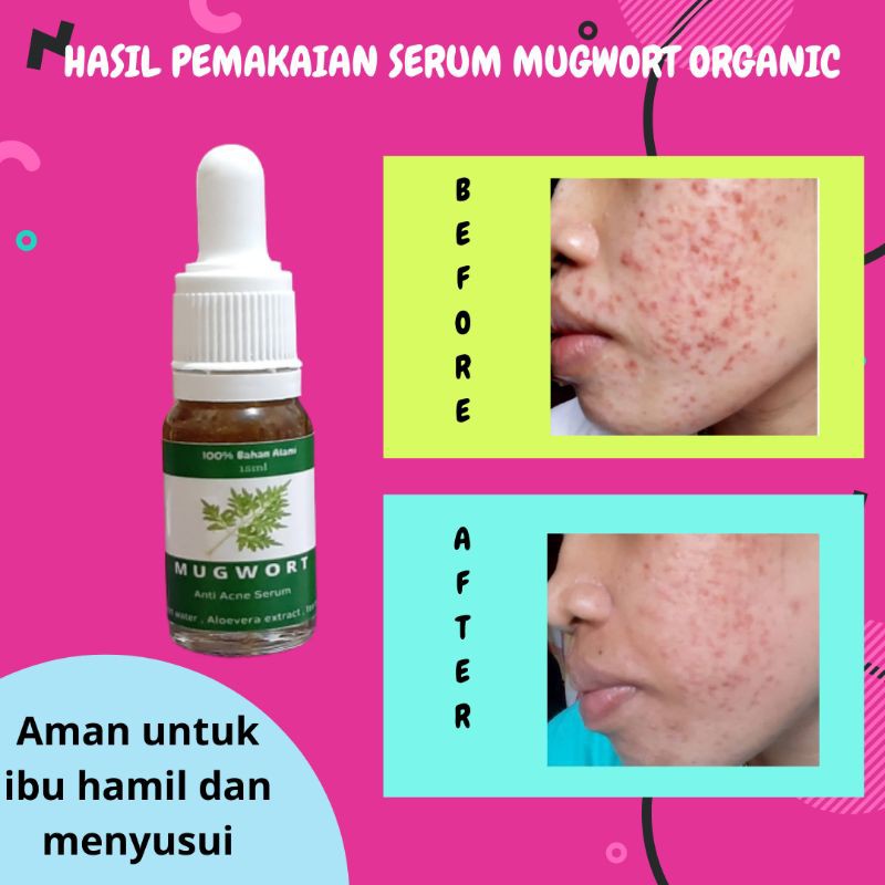 (Hàng Mới Về) Serum Mugwort Làm Trắng Sáng Da Trị Mụn Se Khít Lỗ Chân Lông Cho Nam