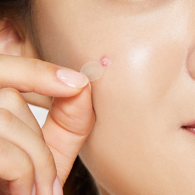 Miếng dán mụn Mayan Care Hàn Quốc hút mụn sưng đỏ mụn bọc ngừa sẹo hiểu quả