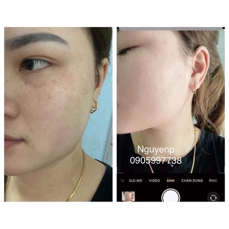 Kem dưỡng da tái tạo đông y MH ⚡ MẪU MỚI ⚡ kem dưỡng tái tảo da nhẹ nhàng đào thải các tế bào chết hiệu quả