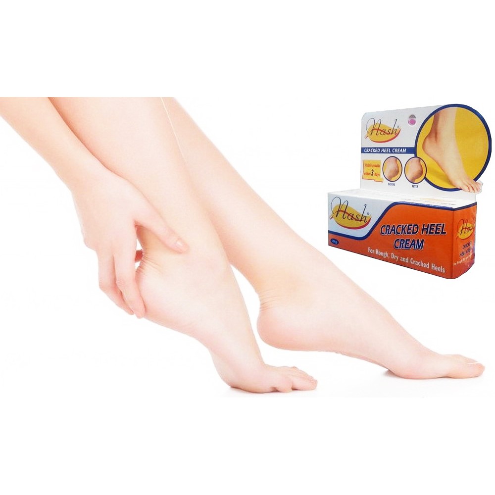 Kem Chống Nứt Gót Chân Nash Cracked Heel Cream 25g