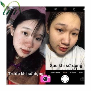 Thảo Mộc Xanh ×5