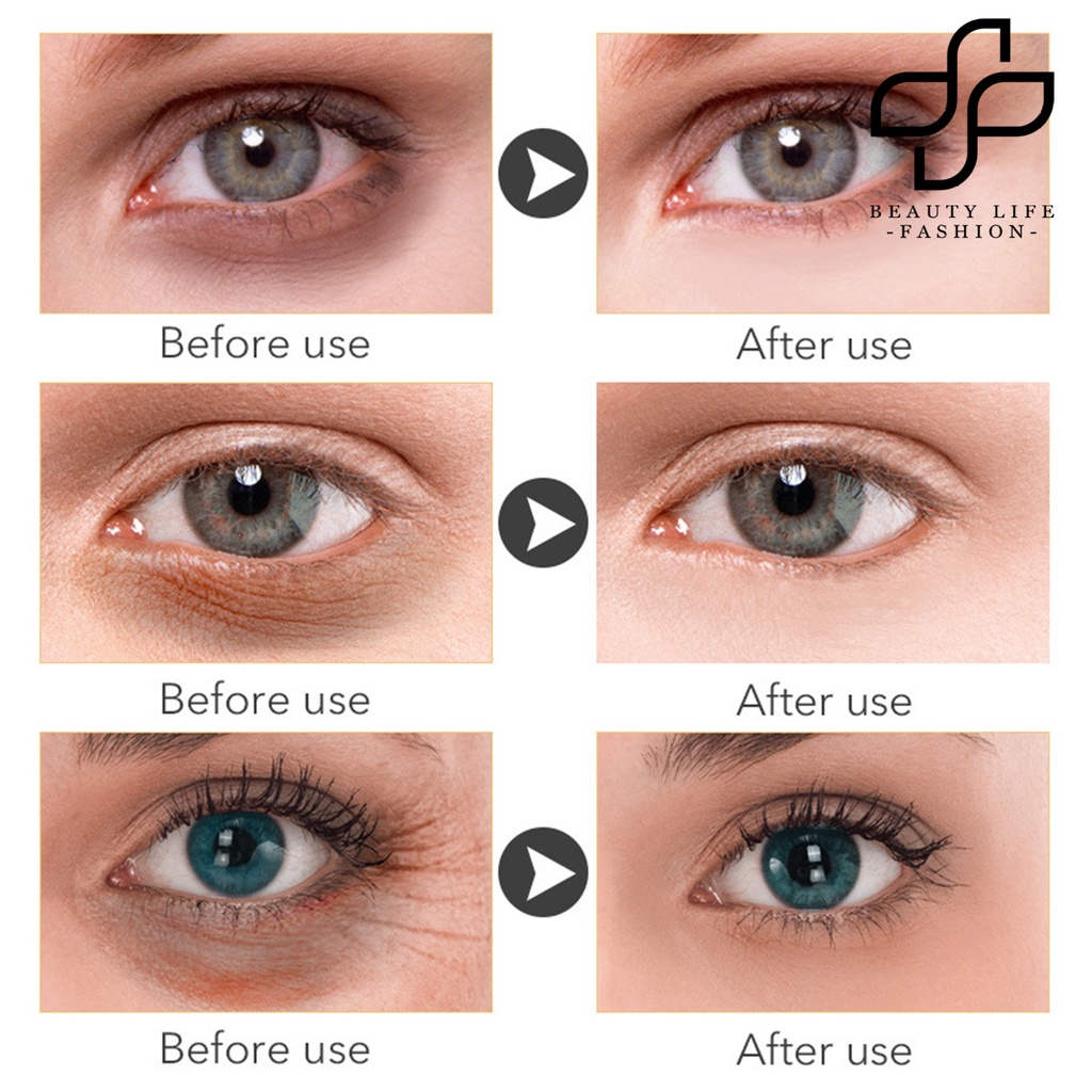 [Hàng mới về] Kem dưỡng da mắt retinol làm sáng da chăm sóc loại bỏ bọng mắt hiệu quả nhanh chóng