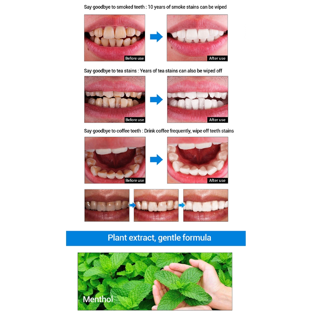 Tinh Chất Làm Trắng Răng LIUFUCAOBEN Ycmb Loại Bỏ Mảng Bám Hiệu Quả