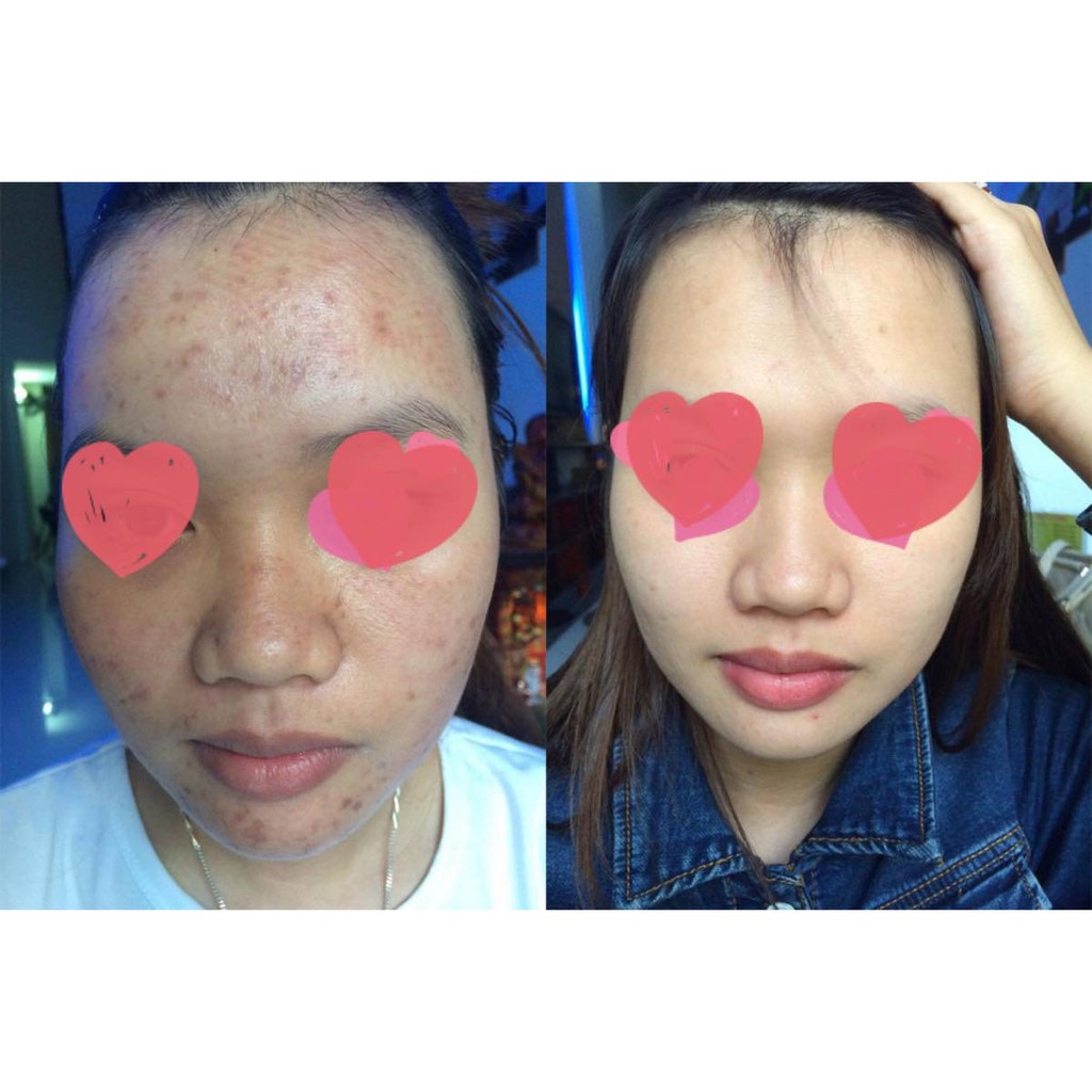 Serum Hoa Đào Dưỡng Da | BigBuy360 - bigbuy360.vn