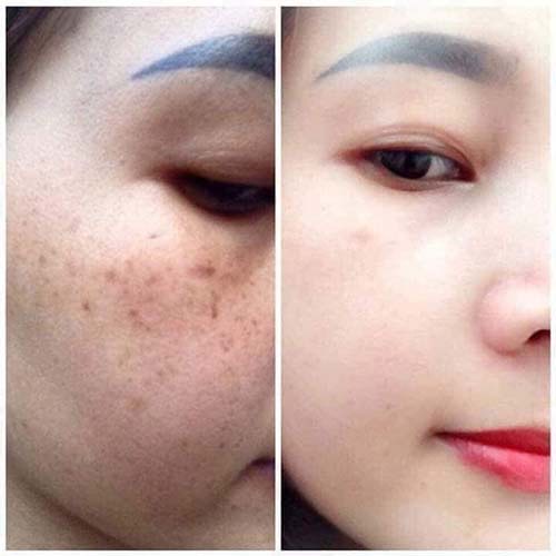 BEAUTY SKIN viên sủi COLLAGEN hỗ trợ làm đẹp da, trắng da, giảm nám tàn nhang, chống lão hoá