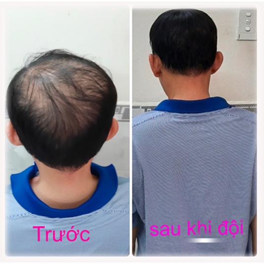 Tóc Giả Ngắn Dành Cho Nam - Chất lượng số 1
