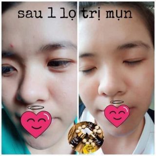 Serum Dm beauty