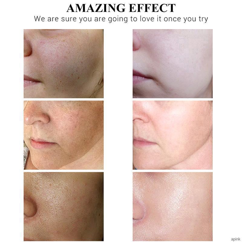 Kem Vitamin C Dưỡng Ẩm Làm Sáng Da 50g