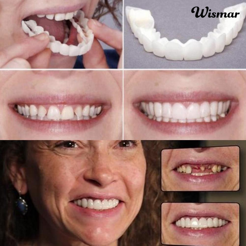 Set 2 Hàm Răng Giả Bằng Silicon Tính Thẩm Mỹ Cao