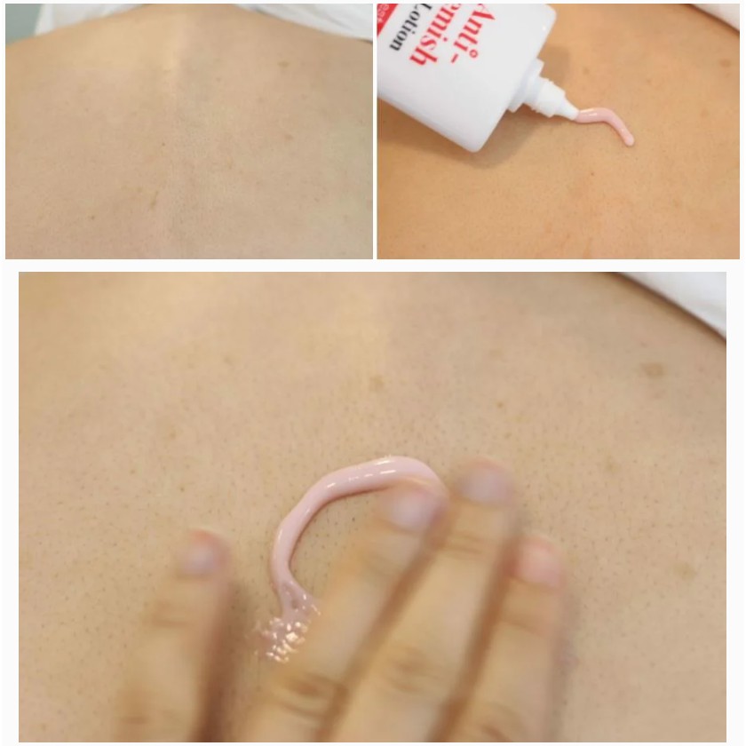 Sữa Dưỡng Thể Chăm Sóc Da Mụn, Mờ Thâm, Dưỡng Trắng Cho Cơ Thể Tiam Anti-Blemish | BigBuy360 - bigbuy360.vn