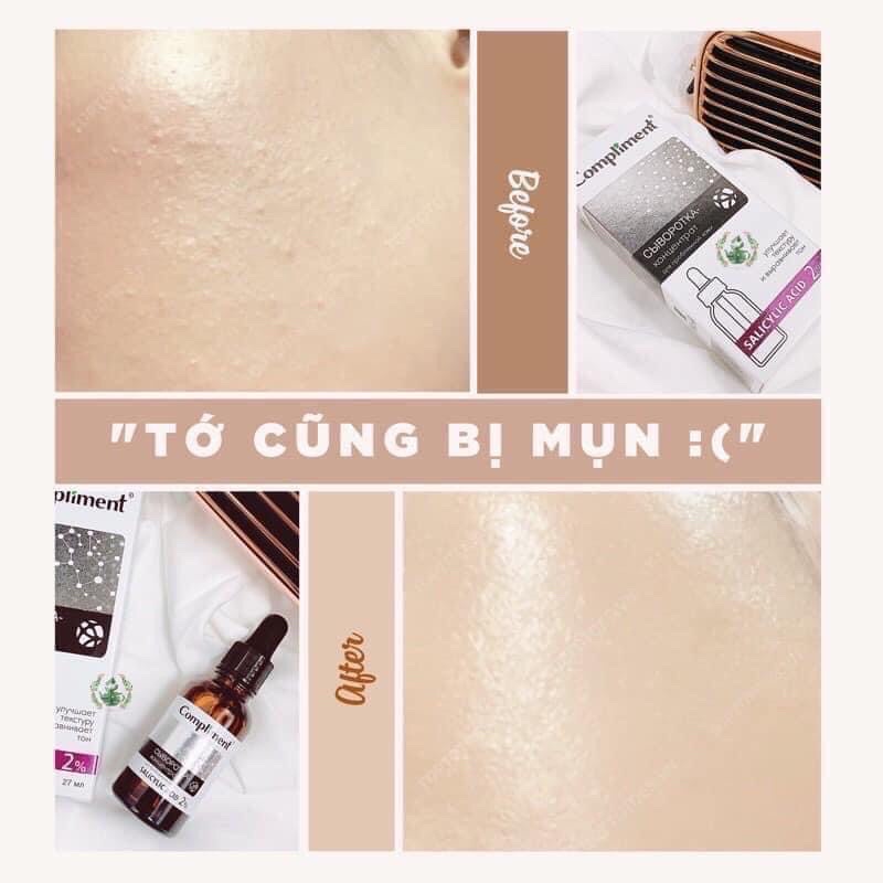 Serum Compliment 2% BHA ,5% Hyaluronic Acid & 20% Vitamin C , se lỗ chân lông , kiềm dầu ,cấp ẩm & đều màu sáng da