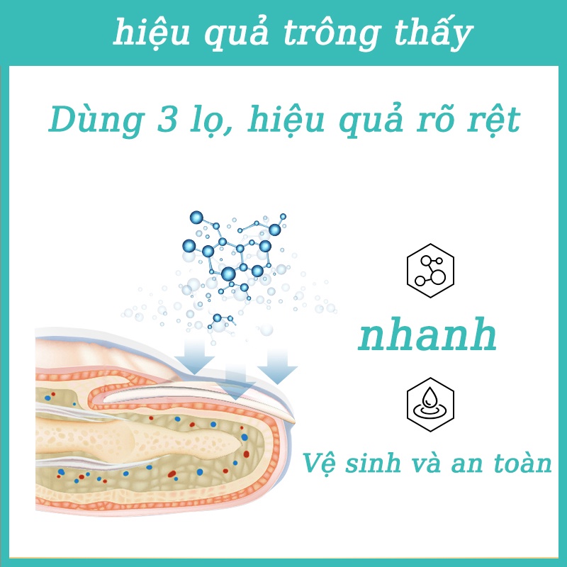 Kem Dưỡng Móng Phục Hồi Móng Nấm 15g- Móng Hư Tổn Móng kháng khuẩn chân loại nấm móng gãy móng chống các bệnh nấm móng nhanh dùng nam và nữ Móng kháng khuẩn