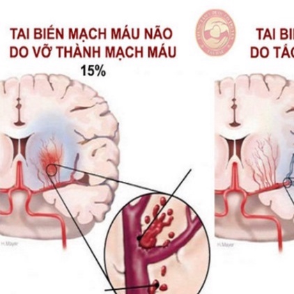 An Cung Ngưu Hoàng Hoàn