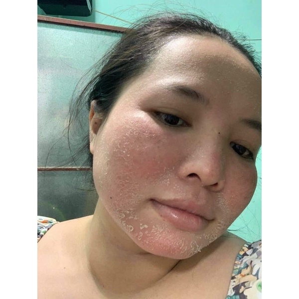 TINH CHẤT TÁI TẠO ĐÔNG Y - Ko sưng ,đỏ chai 20 ml handmade