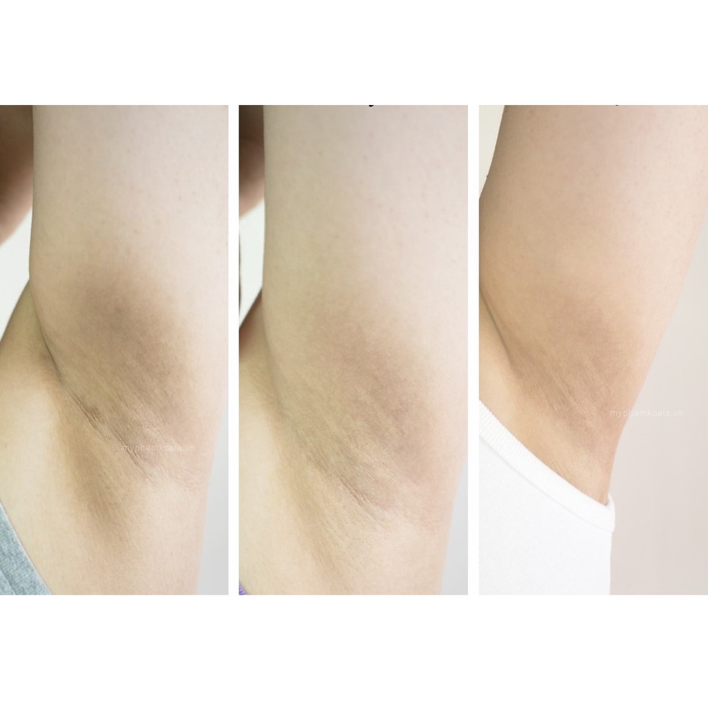 Xà Phòng Giảm Thâm Nách Và Làm Sạch Cơ Thể Pelican Cleansing Soap For Black Spots Nhật Bản 100g