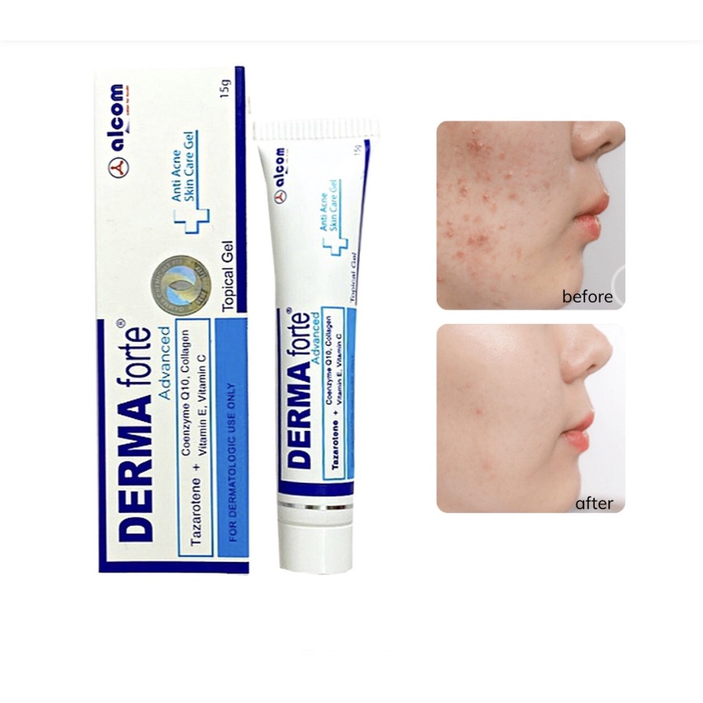 Gel Giảm Mụn Mờ Thâm Derma Forte 15g