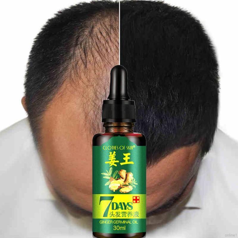 [Hàng mới về] Serum trị liệu dưỡng và chống rụng tóc tinh chất gừng