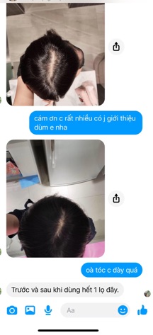 XỊT BƯỞI KÍCH THÍCH MỌC TÓC