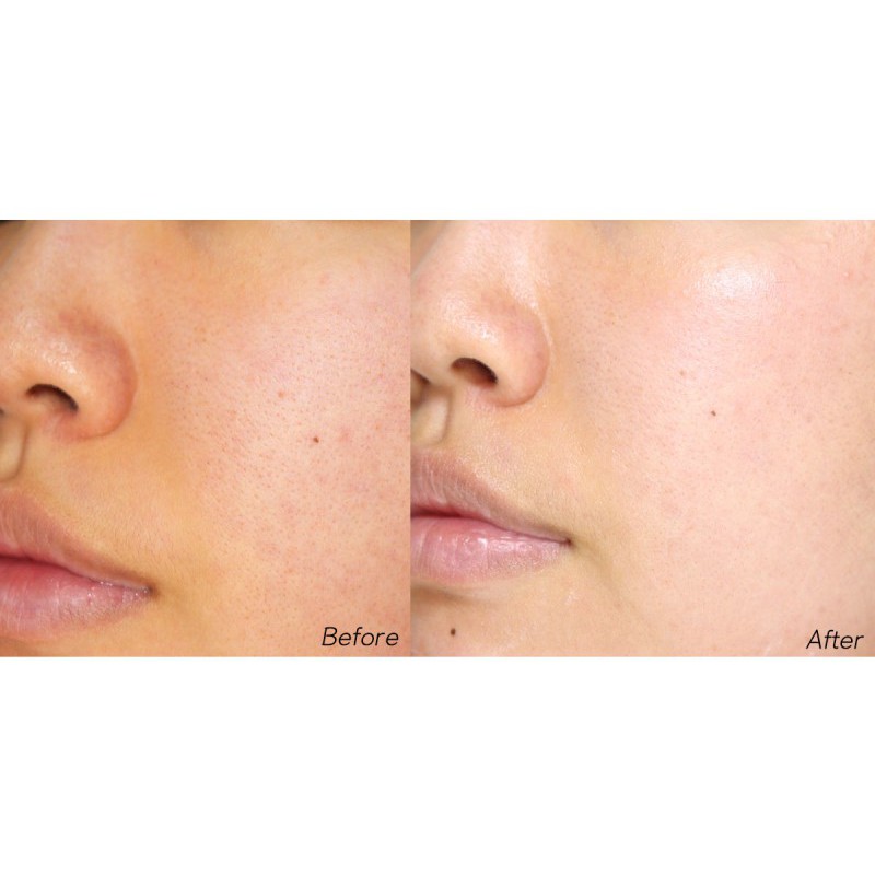 Serum Dưỡng Trắng Mờ Nám DongSung Rannce Hàn Quốc